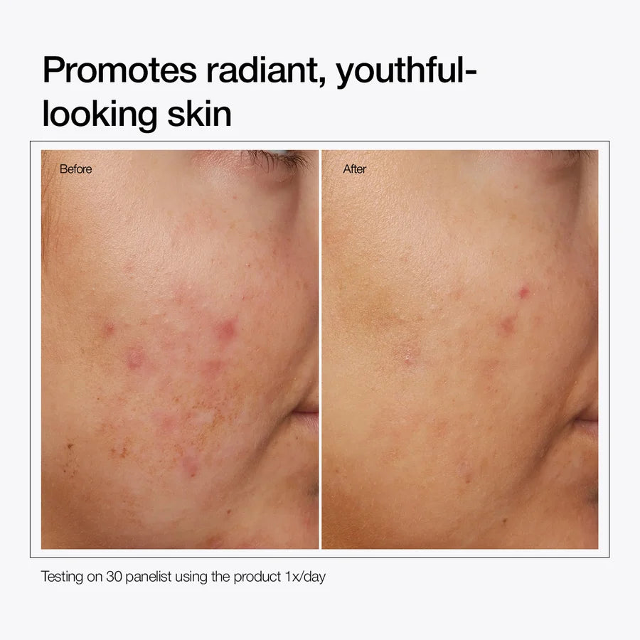 Niacinamide 10% + Zinc 1%